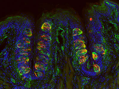 図2　味蕾の免疫染色像